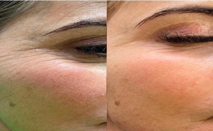 Estética Regenerativa