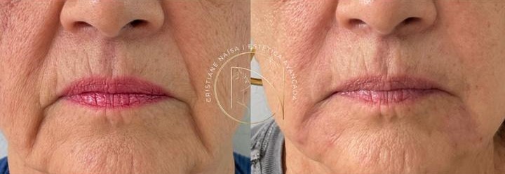 Resultado Estética Facial